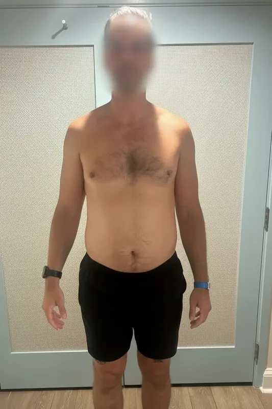 Matt D. before